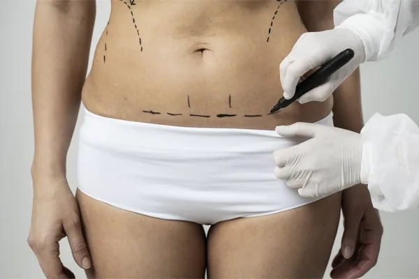 Dr. Volkan Bayraktar - Post-Operatif İzlerin Azaltılması Tedavisi